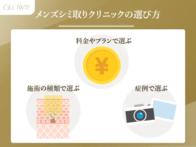 メンズ　シミ取り 選び方